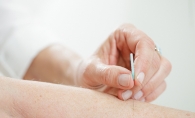 Using an acupuncture needle.